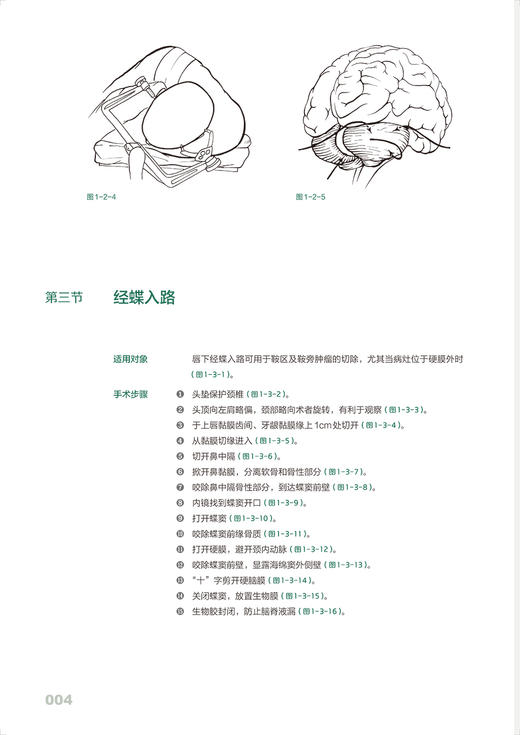 神经外科手绘手术图谱 精准手绘+操作视频+要点注释 徐国成等编 临床手绘手术图谱丛书 常规手术中关键步骤解读 人民卫生出版社 商品图3