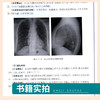 现货正版 手把手教你学X线诊断 影像读片从入门到精通系列 辽宁科学技术出版社 商品缩略图2