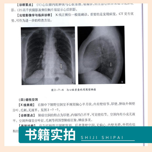 现货正版 手把手教你学X线诊断 影像读片从入门到精通系列 辽宁科学技术出版社 商品图2