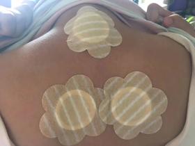  呼吸系统疾病怎么贴三伏贴 