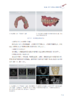 数字化口腔种植的临床实践 商品缩略图2