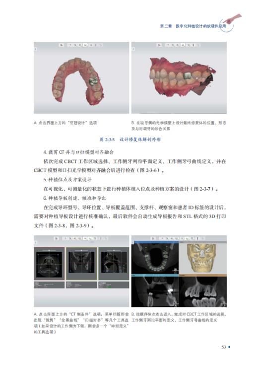 数字化口腔种植的临床实践 商品图2