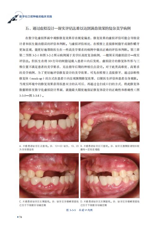 数字化口腔种植的临床实践 商品图5