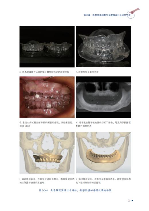 数字化口腔种植的临床实践 商品图4