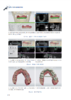 数字化口腔种植的临床实践 商品缩略图3