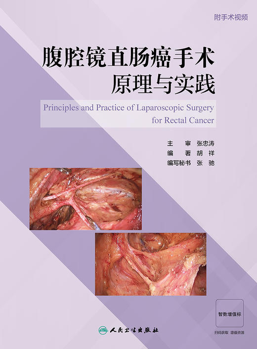 腹腔镜直肠癌手术原理与实践 9787117348287 2023年6月参考书 商品图1