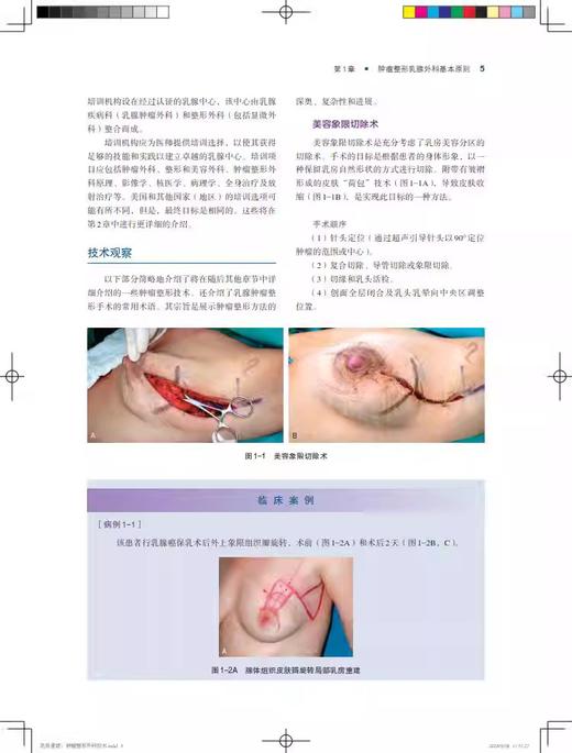 乳房重建 肿瘤整形外科技术 适合整形外科 乳腺外科等相关专业医师及医学书参考 扫码获取视频 上海科学技术出版社9787547861318 商品图4