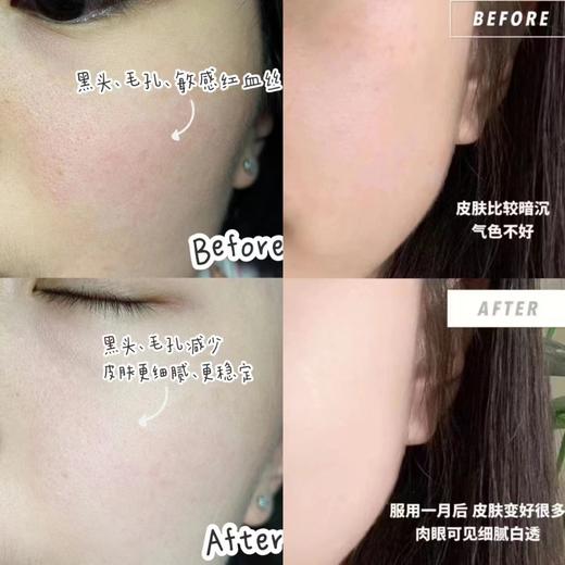 虾青素升级版来啦❗❗贵妇奢宠美白秘密 【Scenkan EVNI联名款虾青素胶囊】半个娱乐圈都在吃的细胞级美白丸！！ 商品图6