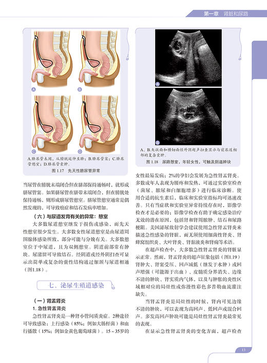 超声诊断学 第5版 泌尿系和腹膜后分册 郑元义等译 附动图 基础解剖学 常见疾病临床表现分型及超声诊断特点 科学技术文献出版社 商品图2