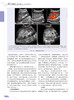 超声诊断学 第5版 泌尿系和腹膜后分册 郑元义等译 附动图 基础解剖学 常见疾病临床表现分型及超声诊断特点 科学技术文献出版社 商品缩略图3