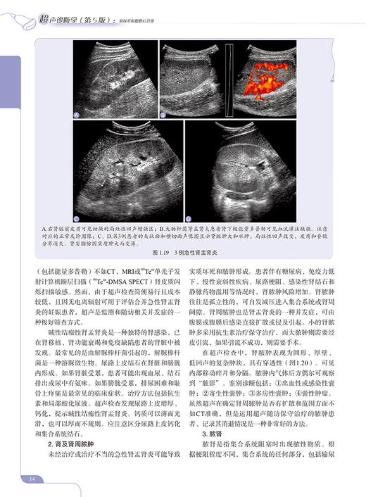超声诊断学 第5版 泌尿系和腹膜后分册 郑元义等译 附动图 基础解剖学 常见疾病临床表现分型及超声诊断特点 科学技术文献出版社 商品图3