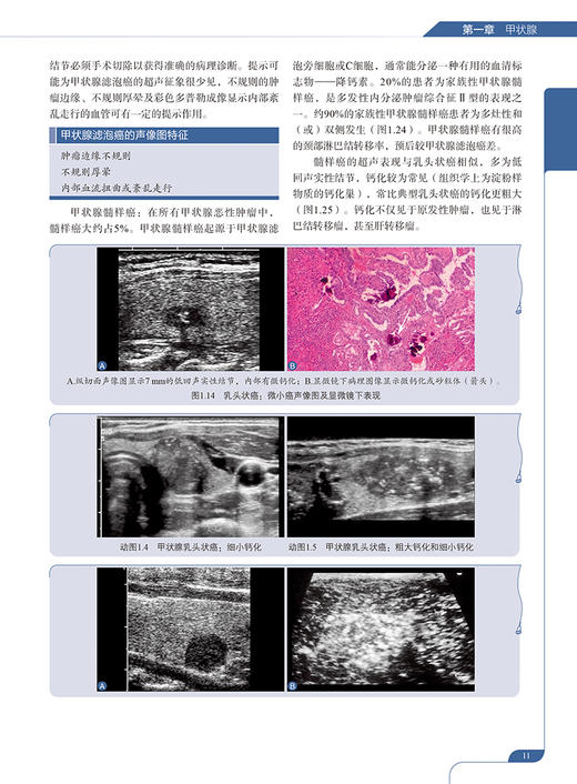 超声诊断学 第5版 浅表器官及肌骨分册 李建初等译 浅表脏器肌骨及周围血管领域超声临床诊疗应用要点检查规范 科学技术文献出版社 商品图3