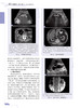 超声诊断学 第5版 泌尿系和腹膜后分册 郑元义等译 附动图 基础解剖学 常见疾病临床表现分型及超声诊断特点 科学技术文献出版社 商品缩略图4