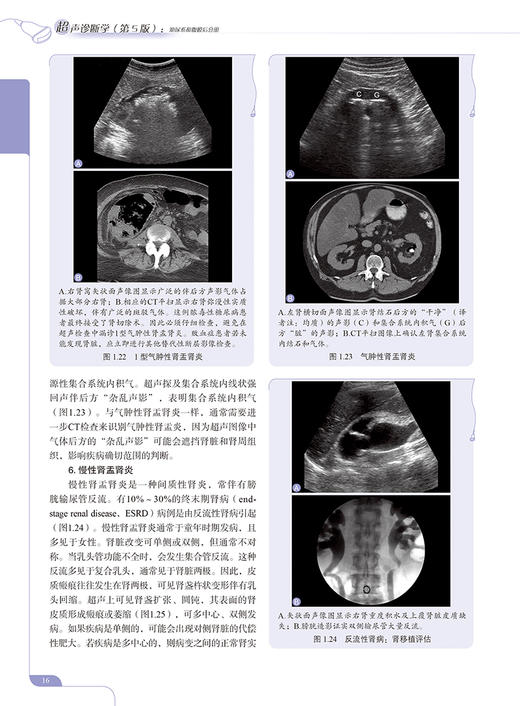 超声诊断学 第5版 泌尿系和腹膜后分册 郑元义等译 附动图 基础解剖学 常见疾病临床表现分型及超声诊断特点 科学技术文献出版社 商品图4