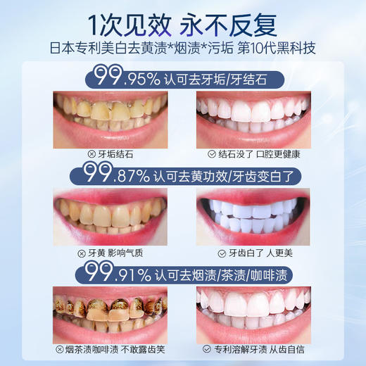 儒意口腔护理多效清洁液30ml 牙结石去除器 去牙渍牙垢 去黄美白牙齿 清除去口臭  | 儒意官方商城 商品图1