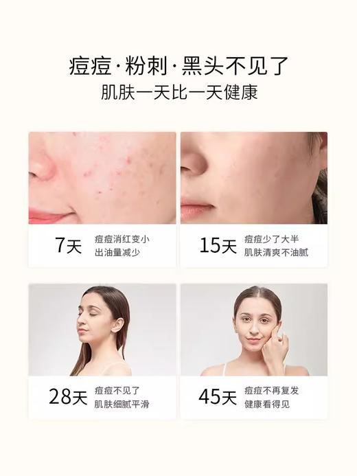【硫磺净痘洁面乳120ml】源自死海的天然硫磺 除螨养肤 特别针对粉刺 痘痘 黑头 商品图5