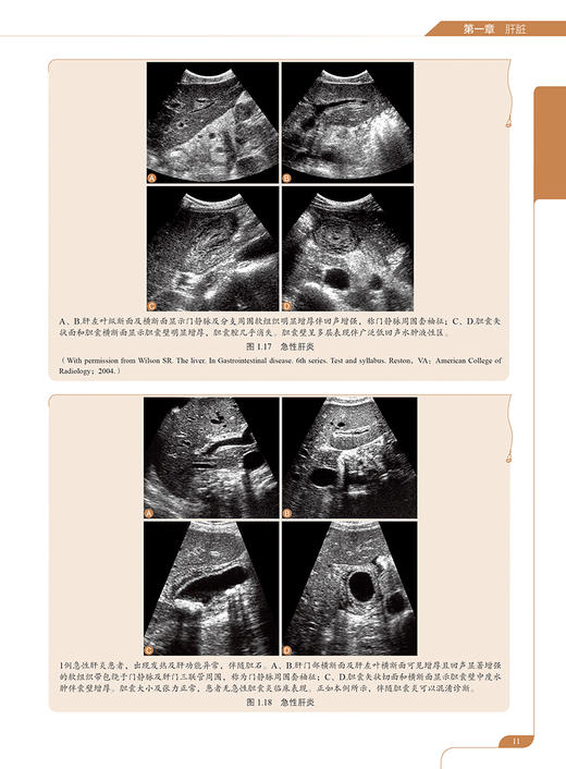 超声诊断学 第5版 消化系统分册 梁萍等译 肝脏脾脏胰腺胆道系统等脏器检查 超声影像诊断技术 基本技能规范 科学技术文献出版社 商品图4