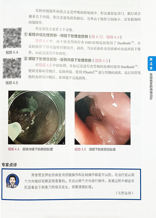 食管 胃 十二指肠ESD 操作 诊断和治疗基础与技巧 林香春 主译 随书赠送实操视频 北京科学技术出版社 9787571429928 商品图2