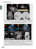 超声诊断学 第5版 小儿分册 张梅等译 附动图 小儿经颅多普勒胸部超声检查 髋关节肌骨超声应用 儿科疾病诊疗 科学技术文献出版社 商品缩略图4
