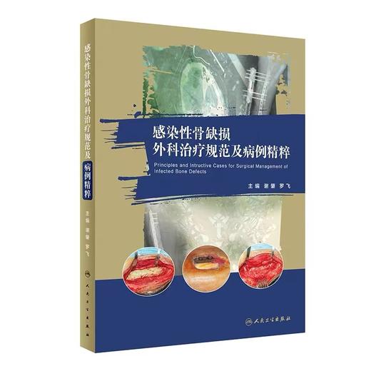 感染性骨缺损外科治疗规范及病例精粹  主编 	谢肇  罗飞  人卫出版 商品图0