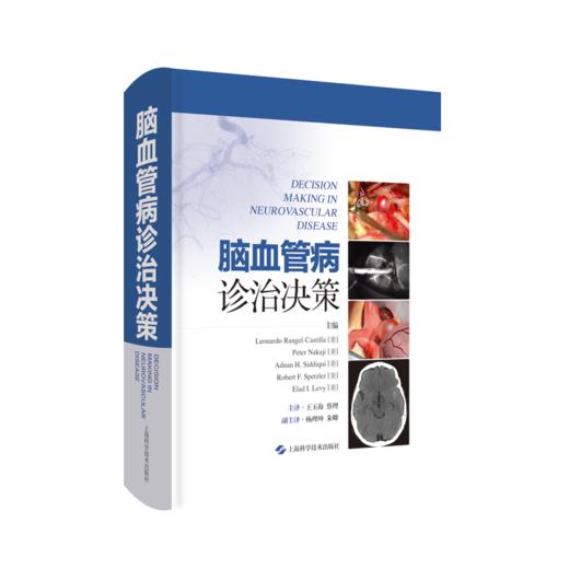 脑血管病诊治决策 商品图0