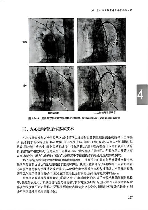 心房颤动 夏云龙 龙德勇等编 常见心血管疾病 房颤流行病学基础研究药物消融治疗 临床医护人员心电医师等工具书 人民卫生出版社 商品图4