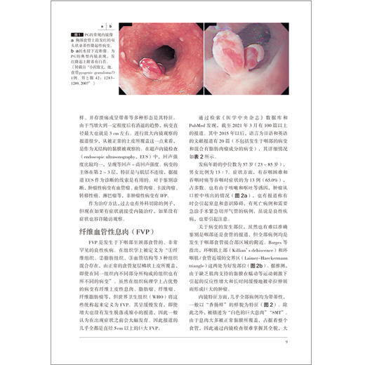 胃与肠 上消化道非肿瘤性x息肉的内镜表现和病理学表现 胃与肠翻译委员会译 消化系统疾病息肉内窥镜检病理学 辽宁科学技术出版社 商品图3