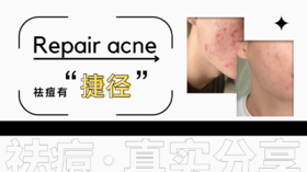 满脸痘痘到现在的好肌肤，他们都用了……