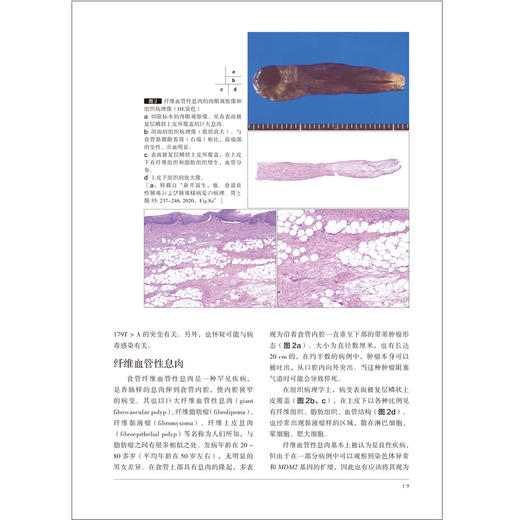 胃与肠 上消化道非肿瘤性x息肉的内镜表现和病理学表现 胃与肠翻译委员会译 消化系统疾病息肉内窥镜检病理学 辽宁科学技术出版社 商品图4