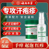 【DR.WLEN】迪王英文风菩利膏汗包膏珍汗泡疱疹膏手上小水泡汗状疱疹专用软膏 商品缩略图2
