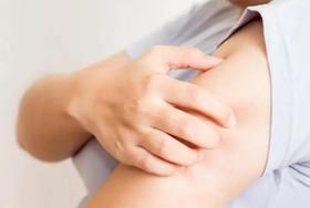  湿疹、感冒的特效穴！一按就灵，效果看得见 