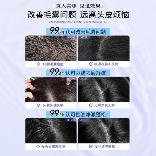 【买1送1】三个魔发匠二硫化硒控油去屑洗发水 控油蓬松 去屑柔顺 深入头皮缓解有害物滋生 实测有效 商品图4