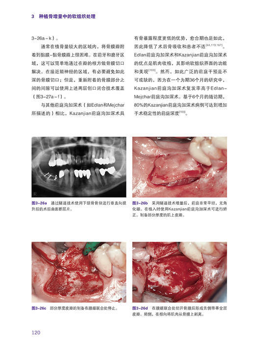 口腔种植软硬组织增量 张健主译 口腔外科学种植治疗 基于现代生物学原理进行骨增量的实用方法 软硬组织增量 辽宁科学技术出版社 商品图3