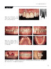 新时代牙周外科 从切开缝合起步在显微镜下提升手术技法 佐藤琢也著 吕达张泓灏译 口腔种植书籍 辽宁科学技术出版社9787559129543 商品缩略图3