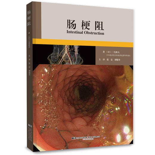 《肠梗阻》 商品图0