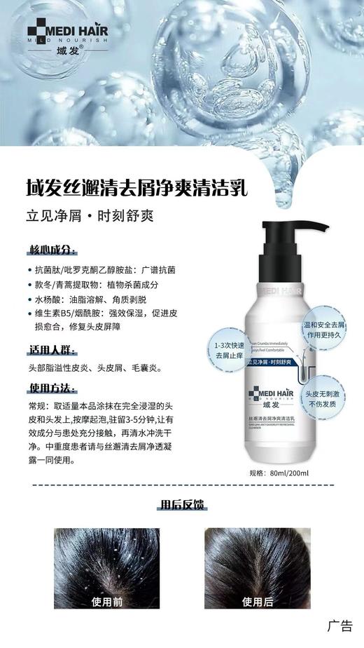 域发头痒头屑组套：款冬去屑止痒洗发露200ml+丝邂清去屑净爽清洁乳80ml 商品图1