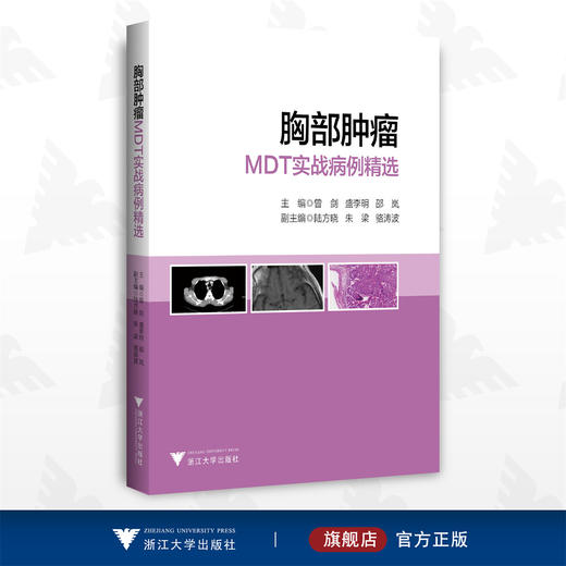 胸部肿瘤MDT实战病例精选/临床精析病例集锦/曾剑/盛李明/邵岚/浙江大学出版社/病例集 商品图0