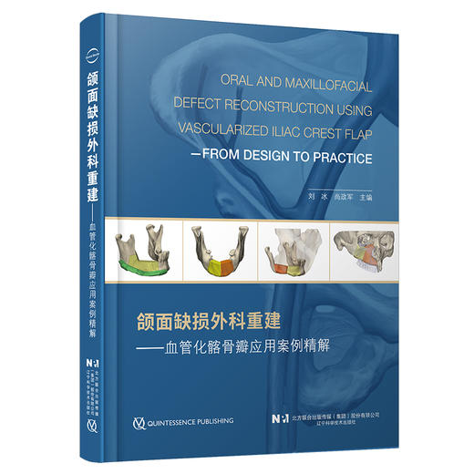 《颌面缺损外科重建——血管化髂骨瓣应用案例精解》 商品图0