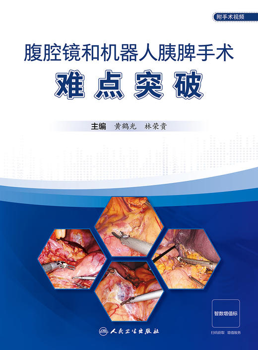 【预售】腹腔镜和机器人胰脾手术难点突破 2023年7月参考书 9787117348768 商品图1