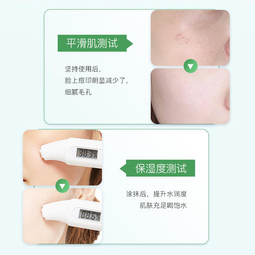 【第二件立减5元】HEYXI韩媛熙胶囊芦荟胶，安全纯净的大自然补水保湿精华，有效修复收缩毛孔，祛痘去印。300ml长效补水，让肌肤保持活力水润。 商品图2