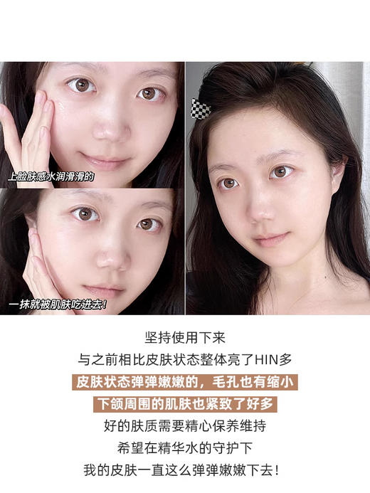 【7.20大牌再降价】奥伦纳素冰白精华50ML 商品图4