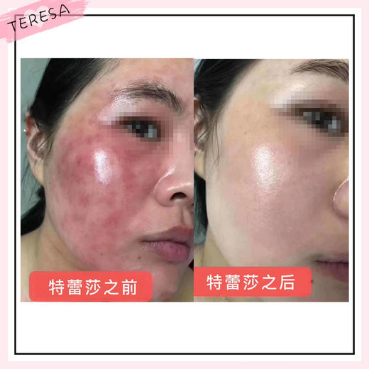 【新包装 线下专供】50ml蓝莲花保湿乳 针对脆弱受损肤质 （前修护乳配方） 商品图2