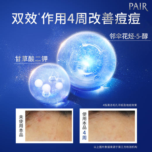 LION狮王 PAIR沛丽尔清痘洁肤洗面奶80g 商品图2