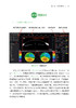 Scheimpflug眼前节综合诊断分析仪临床应用 黄锦海 该类设备技术原理界面介绍读图方法指导临床应用 眼科疾病案例 人民卫生出版社 商品缩略图4