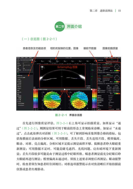 Scheimpflug眼前节综合诊断分析仪临床应用 黄锦海 该类设备技术原理界面介绍读图方法指导临床应用 眼科疾病案例 人民卫生出版社 商品图4