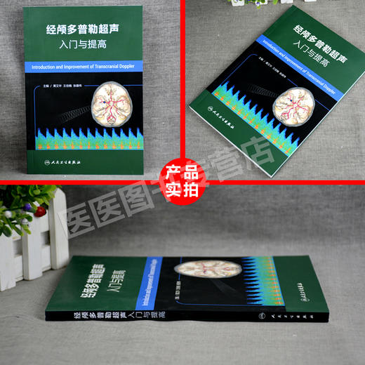 经颅多普勒超声入门与提高 商品图2