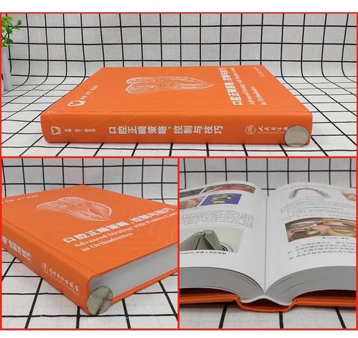 两本套装 口腔正畸策略控制与技巧+口腔正畸学基础 技术与临床 正畸书籍专科教程当代正畸书临床治疗设计入门现代高效矫治儿童 商品图3
