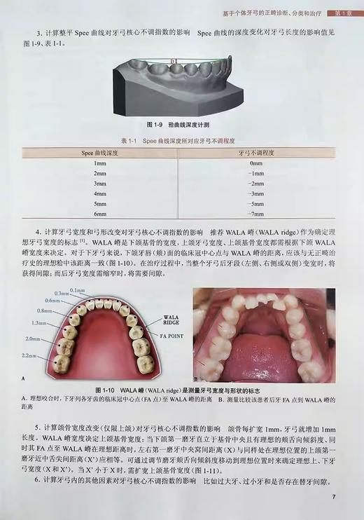 两本套装 口腔正畸策略控制与技巧+口腔正畸学基础 技术与临床 正畸书籍专科教程当代正畸书临床治疗设计入门现代高效矫治儿童 商品图4