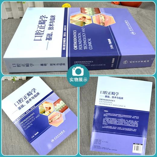 两本套装 口腔正畸策略控制与技巧+口腔正畸学基础 技术与临床 正畸书籍专科教程当代正畸书临床治疗设计入门现代高效矫治儿童 商品图2