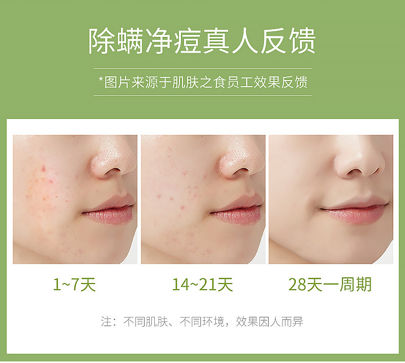 日除螨皂详情_11.jpg